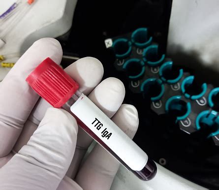 ttg blood test bottle colour|ttg iga test accuracy.